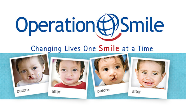 Operation Smile Surgery